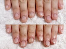 グレースレディ 大阪店/(深爪/長さだし/フィルイン)