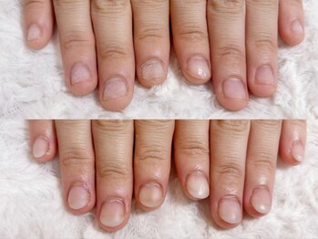 グレースレディ 大阪店/(深爪/長さだし/フィルイン)