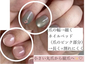 マアサネイル(Maasa nail)/before after