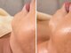 リノエデボーテ(Rinoe’ de beaute)の写真/年齢とともに気になるホウレイ線やたるみを徹底ケア。上向きのハリ肌を叶える大人のための本格リフトケア！