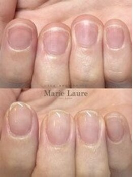 マリーロール 梅田店(Marie Laure)/自爪育成/深爪矯正/ネイルケア