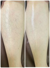 エン(en.)/BeforeAfter写真35