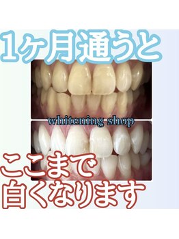 ホワイトニングショップ 岐阜駅前/#岐阜ホワイトニング#岐阜エステ