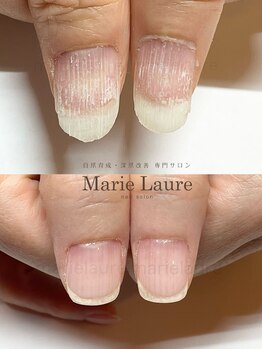マリーロール 淀屋橋本店(Marie Laure)/自爪育成/深爪矯正/ネイルケア