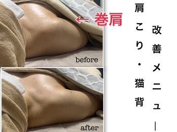 ミュー(Mieux)/肩こりも!脚も痛い!