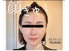 【驚きのリフトアップ★理想の小顔・たるみケアに】テラボーラー