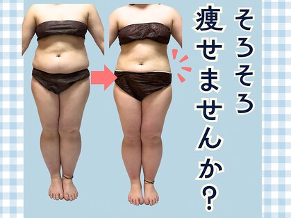 ヨサパーク 美 キレイ(YOSA PARK 美 Kirei)の写真