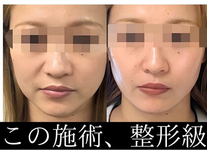 ナナイロ(nanairo)の写真