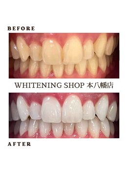 ホワイトニングショップ 本八幡店の写真/セルフホワイトニング専門店で理想のお色に☆簡単且つスピーディーにホワイトニングができるサロン