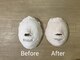 アジアンビューティー(Asian Beauty)の写真/はがさない美肌育成ピーリング【ララピール】艷やかな毛穴レス美肌へ
