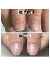 プレシャスハート 広島(Precious Heart)/◆育成◆育成経過写真