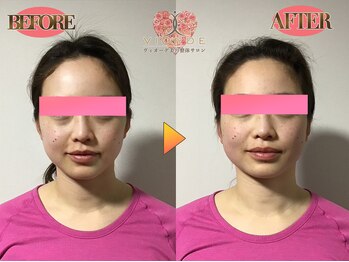 ヴィオーデ 銀座店/小顔、リンパ、ヘッドスパ、整体