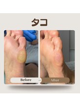 巻き爪補正店 那覇店/