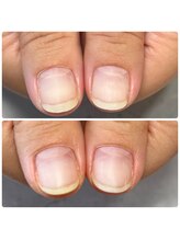 ルアマナ(Luamana)/自爪育成・クリア