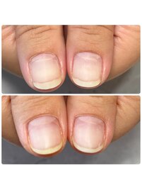 自爪育成・クリア