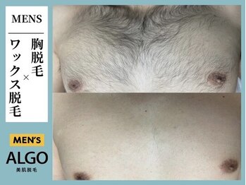 アルゴ 柳川店(ALGO)/胸WAX脱毛