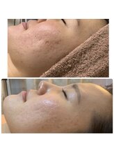 シェルビー(Cielbe.)/陶肌トリートメントで素肌美人に