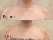 ハリニーク 銀座店(HARINIQ)/首肩鍼灸&経絡リンパ