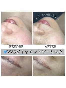 カルナ(CARNA)/VVSダイヤモンドピール