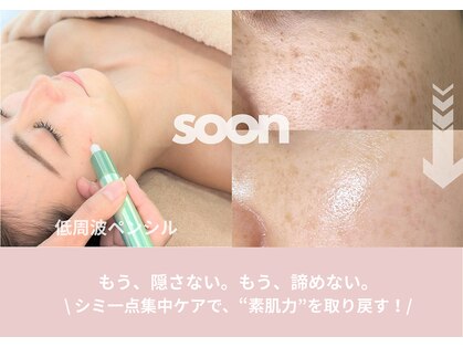 スーン(soon)の写真