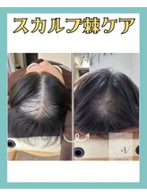 リリベル(LilyBell)/Before After