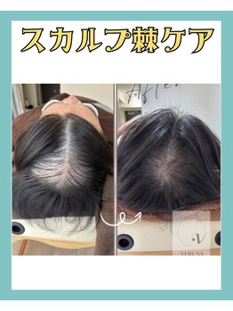 リリベル(LilyBell)/Before After