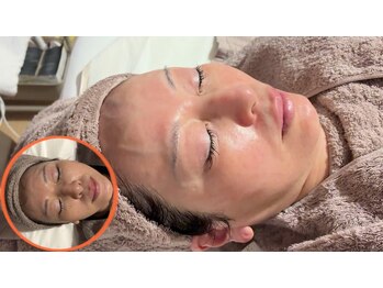 シェリー(CHERIE)の写真/《肌質改善で自分史上最高美肌へ＊》若々しい見た目で周りと差をつける♪毛穴引き締め、ふっくらツヤ感MAX!