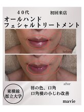 マビイ 都立大学(mavie)/プレミアム素肌トリートメント