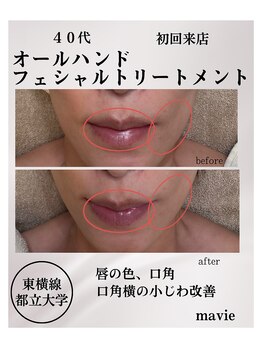 マビイ 都立大学(mavie)/プレミアム素肌トリートメント