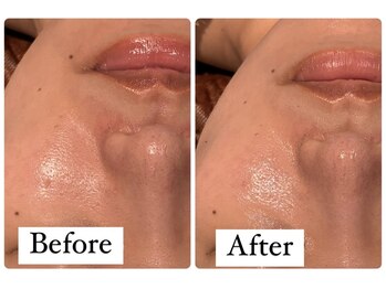 サロンドフェイス 木曽川店(Salon de Faith)/陶肌トリートメント