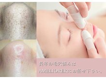 アメリオレ 三鷹店(AMELIORER)の雰囲気（唯一無二の毛穴エクストラクションで、根本から毛穴肌質改善！）