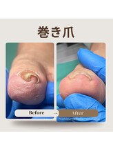 巻き爪補正店 那覇店/