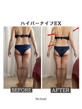 リヘッド(Re.head)/ハイパーナイフEXでくびれ