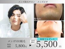 メンズビオ 神戸三宮店の雰囲気（陰部脱毛1回5,500円～都度払いで何度でも自分のペースで通える♪）