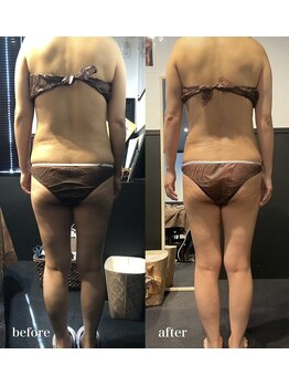 ピーラトゥ 日立(P-Ratu)/上半身集中◎