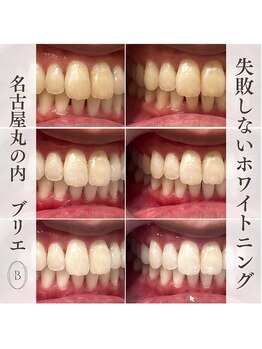 ブリエ(BRILLER)/高効果ホワイトニング　３日間