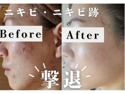 エステティック レイビス 旭川店(RAYVIS)の写真