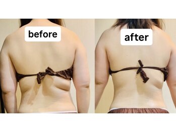 ワイグレイス(Y.GRACE)/ヴィーナスディーバ（4D痩身）