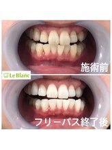 ルブラン 奈良店(Le Blanc)/大満足フリーパスコース！！