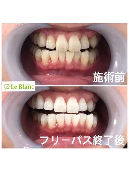 ルブラン 奈良店(Le Blanc)/大満足フリーパスコース!!