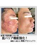 ニキビ根本ケア/本気で肌改善したい方へトラブル知らずの肌へ￥19800→