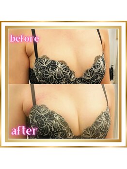 ジュエルリング(Jewel Ring)/バストアップ【恵比寿代官山】