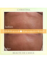 ボーテ ドゥ ランジュ(BEAUTE DE L’ANGE.)/◆フォーエバーヤング◆