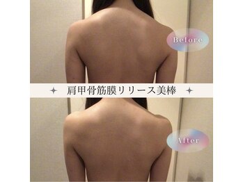 カオヤ プラス(Kaoya plus)/美棒　筋膜リリース