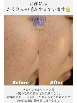 エリス(ELISSE)/美容液、浸透していますか?