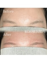 サロンロン 横浜関内(SALON RON)/女性眉毛脱毛！