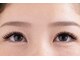 フィアクレー アイ(Vierklee eye)の写真