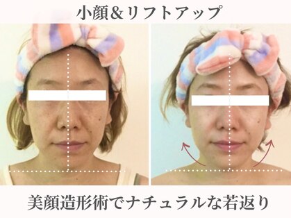 小顔コルギアンドフェイシャルサロン ジュエル(JEWEL)の写真