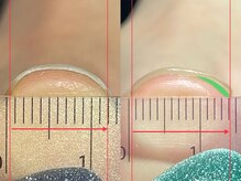 ルーナジェーナ(Luna llena)/【巻爪ケア】UPジェル