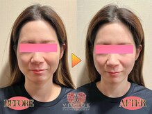 ヴィオーデ 銀座店/小顔、リンパ、ヘッドスパ、整体